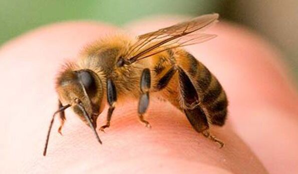 ハチ刺され-男根を拡大する極端な方法